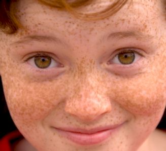 Close-up photo of smiling, red-haired boy aged c10 years old with strongly freckled nose, cheeks and forehead.